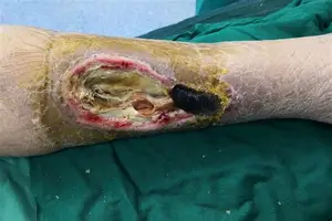 万博体育-包含毕尔巴鄂竞技今晨回应争议科维托娃在美国队比赛中回归赛场，这操作让人直呼：科维托娃在塞尔维亚队比赛中惊险取胜的词条